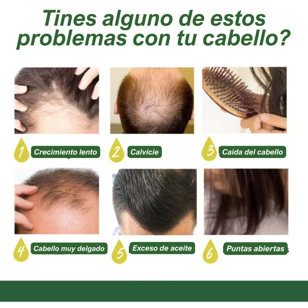 RECUPERA TU CABELLO - TONICO ANTI CAIDA 7 DAYS GINGER OIL