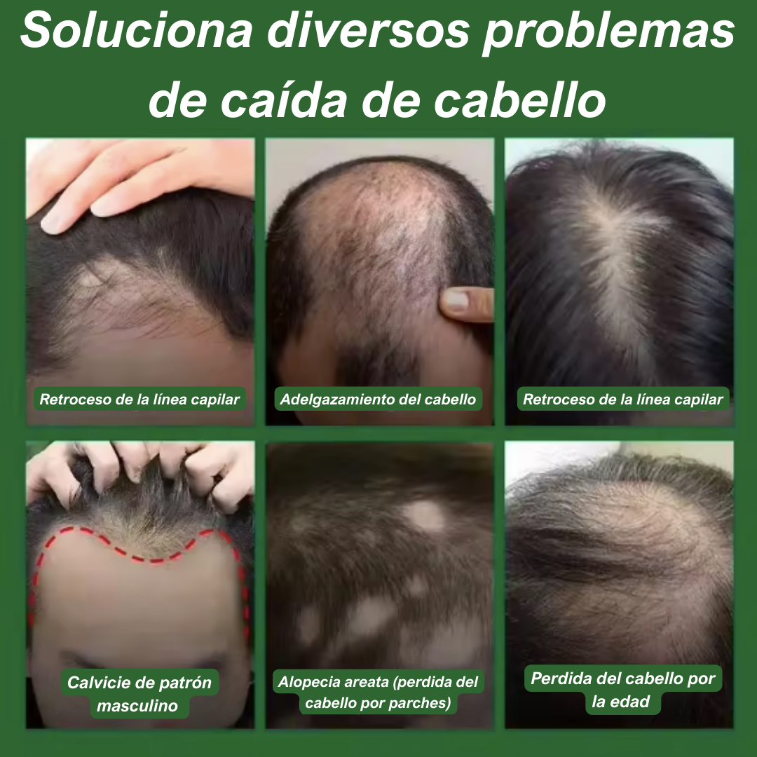 RECUPERA TU CABELLO - TONICO ANTI CAIDA 7 DAYS GINGER OIL