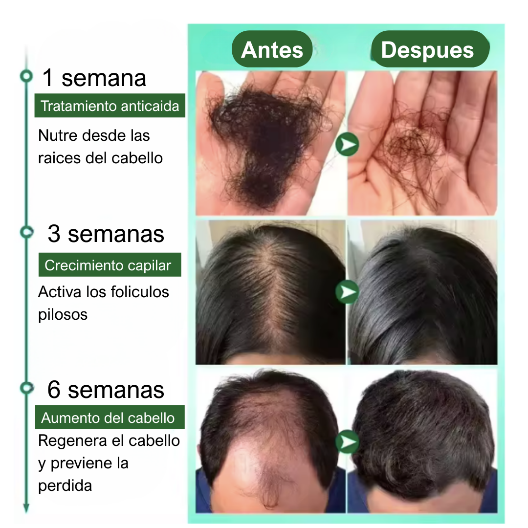 RECUPERA TU CABELLO - TONICO ANTI CAIDA 7 DAYS GINGER OIL