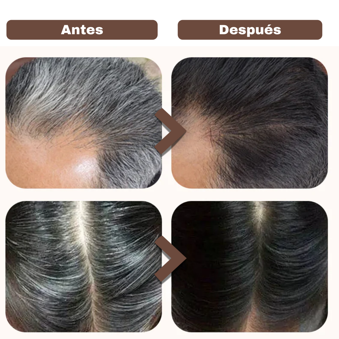 BLACK HAIR DYE™ - SHAMPOO 3 EN 1