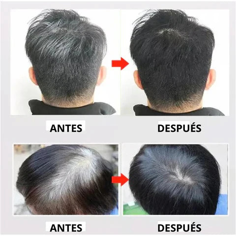 BLACK HAIR DYE™ - SHAMPOO 3 EN 1