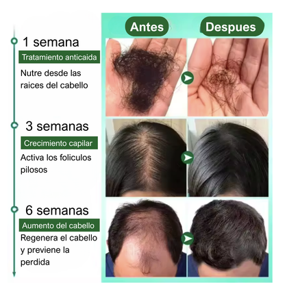 RECUPERA TU CABELLO - TONICO ANTI CAIDA 7 DAYS GINGER OIL